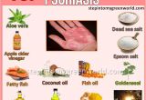 At Home Plan B Remedy 13 Best Psoriasis Images On Pinterest Natural Remedies