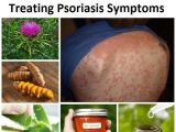 At Home Plan B Remedy 20 Best Home Remedies for Treating Psoriasis Symptoms