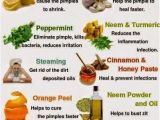 Home Remedies for Family Planning 123 Best Images About Remedies Corner On Pinterest